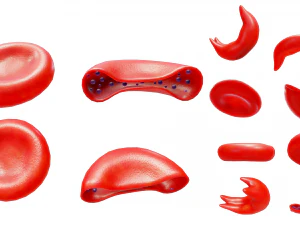 Cross Section of Normal vs Sickle Red Blood Cell 3D Model