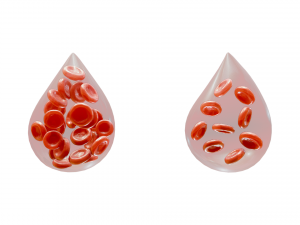 Normal Blood Cells vs Anemia Modèle 3D