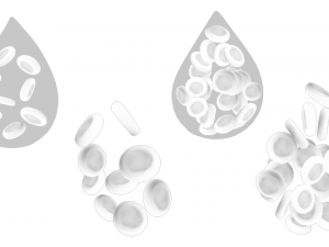 Normal Blood Cells vs Anemia Modèle 3D