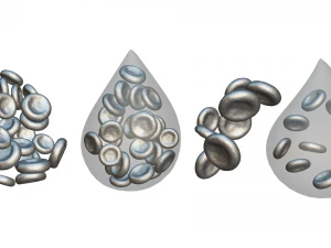 Normal Blood Cells vs Anemia 3D Model