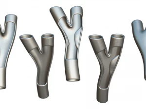 周围动脉疾病 3D 模型