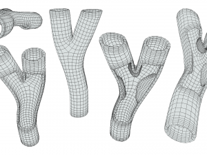 Peripheral Artery Disease 3Dモデル