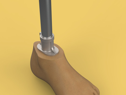 MEDICAL ARTIFICIAL PROSTHETIC LEG MECHANICAL FOUR BAR JOINT 3D Model
