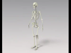 Knee Tumor Prosthesis 3D Model
