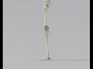 Knee Tumor Prosthesis Modelo 3D