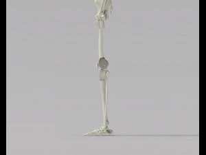 Knee Tumor Prosthesis 3D Model