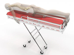 Human Spine and Implant 3D Model