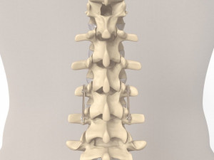 Human Spine and Implant Modèle 3D