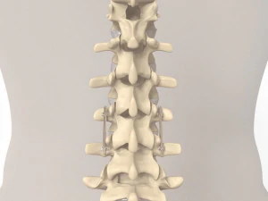 Human Spine and Implant 3D Model