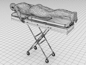 Human Spine and Implant 3D Model