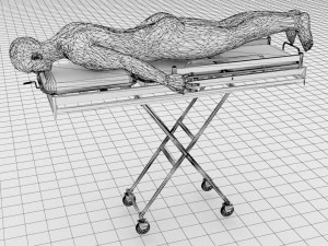 Human Spine and Implant 3D Model