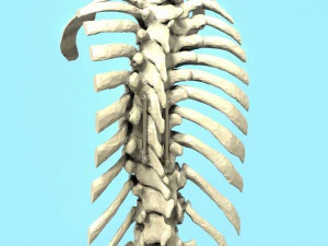 Spine Implant 3D Model