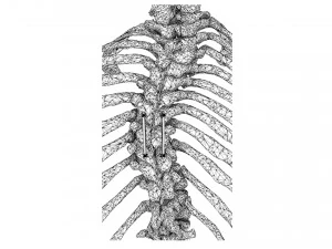 Spine Implant 3D Model