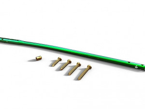 Tibial Intramedullary Nail Modèle 3D