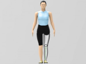 Tibial Intramedullary Nail Modèle 3D