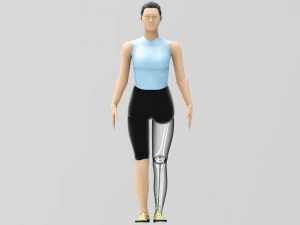 Tibial Intramedullary Nail 3D Model