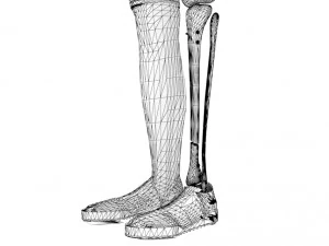 Tibial Intramedullary Nail 3D Model