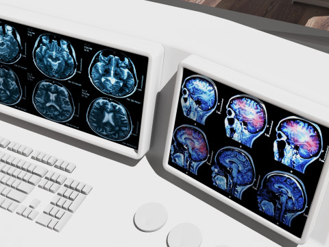 CT Scan - 4K 3D मॉडल