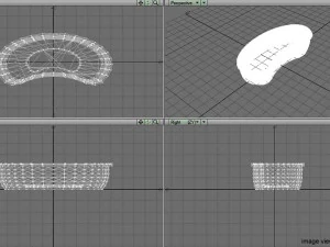 surgical kidney dish 3D Model