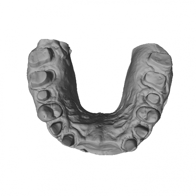 dental anatomy crown stomp crowns molar 3D 모델 .c4d .max .obj .3ds .fbx .stl .blend