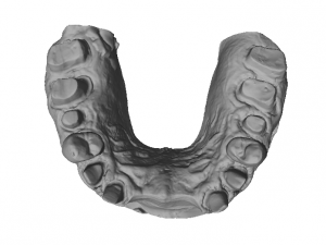 dental anatomy crown stomp crowns molar Model 3D