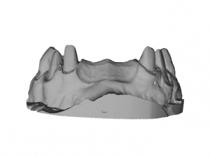 dental anatomy crown stomp crowns molar 3D 모델