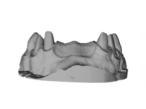 dental anatomy crown stomp crowns molar 3D Model