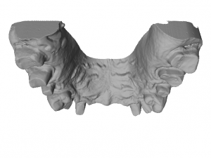 dental anatomy crown stomp crowns molar 3D 모델