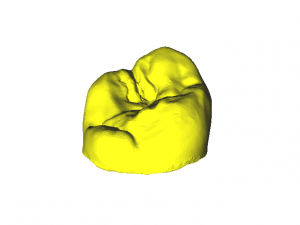 dental anatomy crown stomp crowns molar 3D 모델
