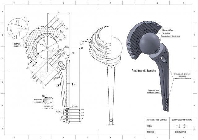 prosthetic hip joint 3d print model Modèles 3D en vedette .c4d .max .obj .3ds .fbx .stl .blend 