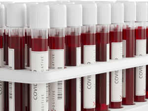 test tubes with blood 3D मॉडल