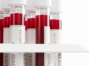 test tubes with blood 3D मॉडल