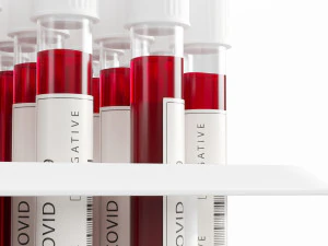 test tubes with blood 3D Model