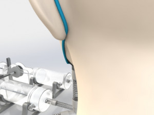 respirador artificial 3D प्रिंट मॉडल