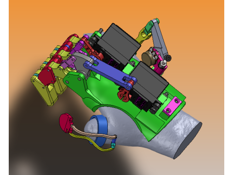 Partial amputation prosthetics mechanical palm structure sw22 editable 3Dモデル