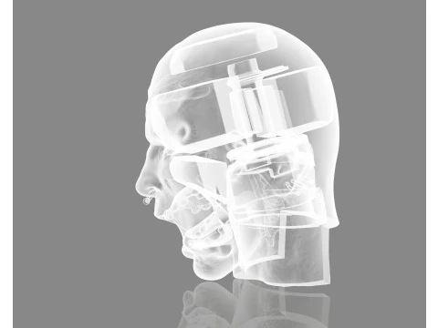 Prisoner Tortured Head 3D Print Model
