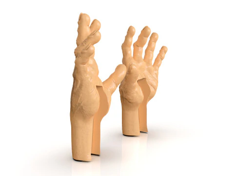 Mani torturate dell'uomo Modello di stampa 3D