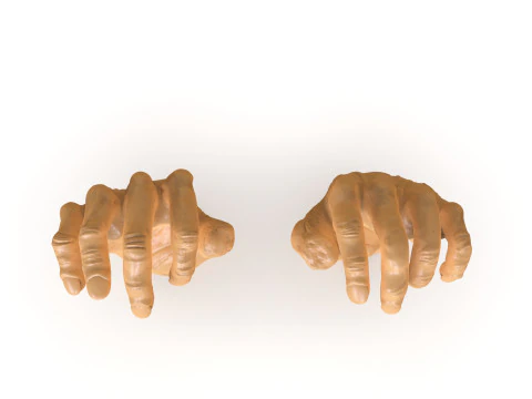 Mutilated Hand 3D Print Model