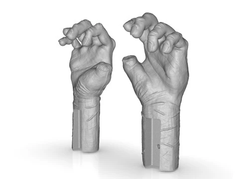 Mutilated Hand 3D Print Model
