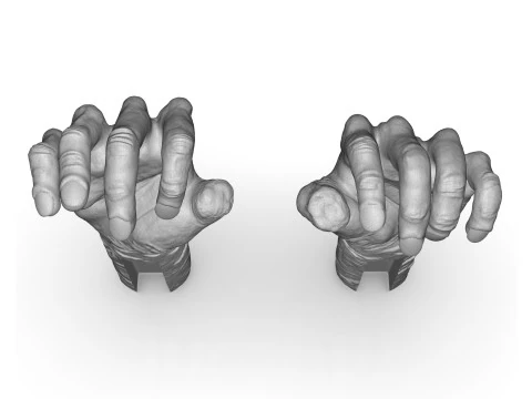 Mutilated Hand 3D Print Model
