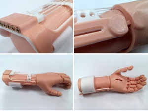 traction arm prosthesis Modelo 3D