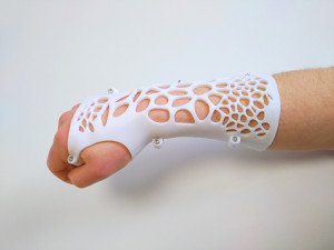 arm splint - 3d print 3D Принт Модель