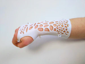 arm splint - 3d print 3D Print Model