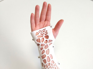 arm splint - 3d print 3D Принт Модель