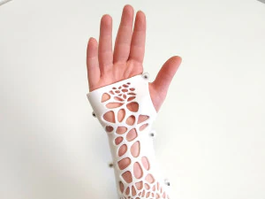 arm splint - 3d print 3D Print Model