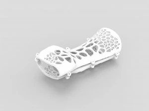arm splint - 3d print 3D Print Model
