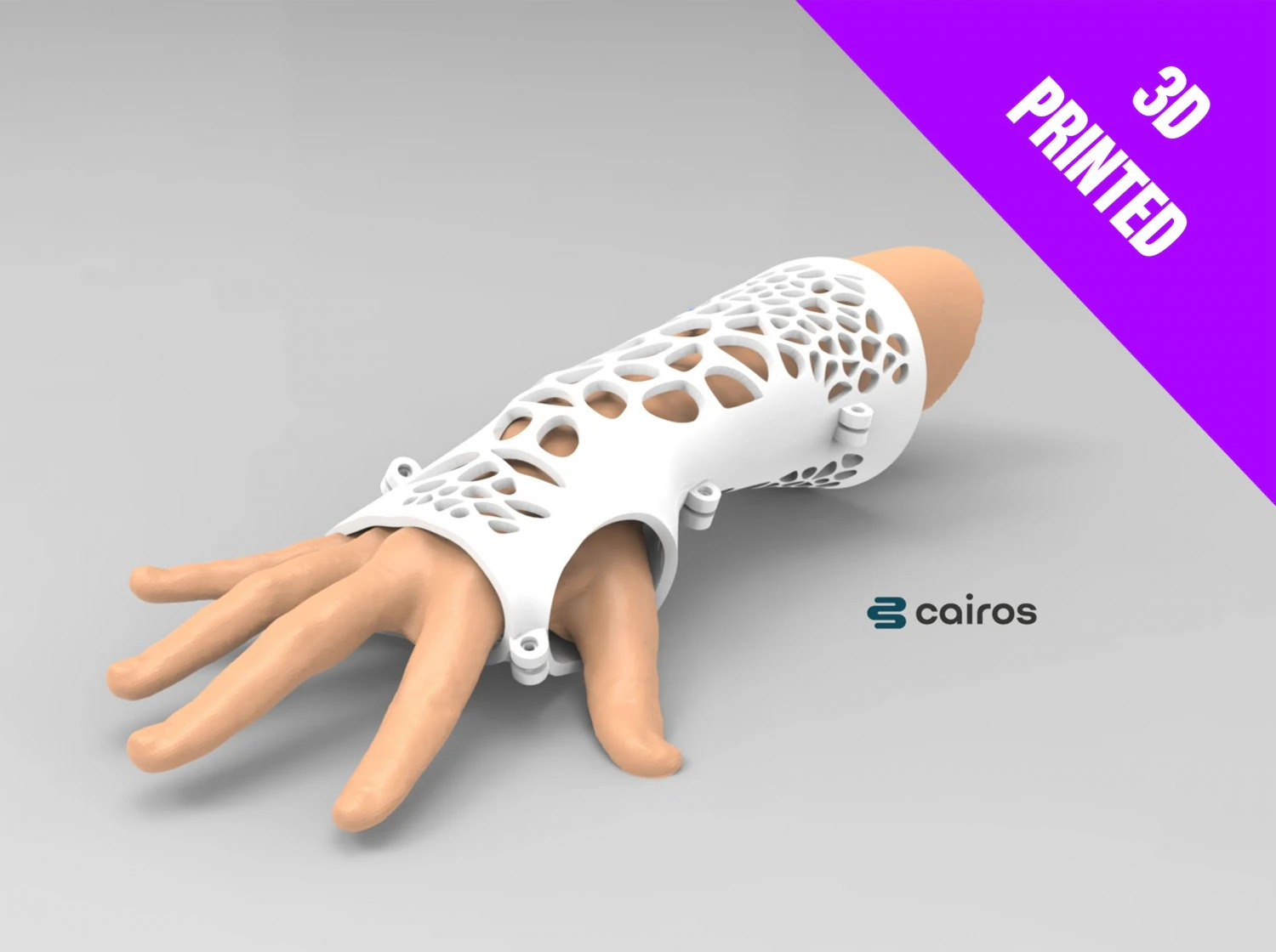 arm splint - 3d print 3D Print Model .c4d .max .obj .3ds .fbx .stl .blend