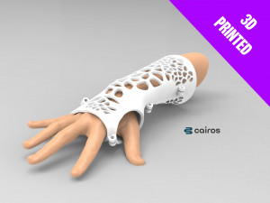 arm splint - 3d print 3D 프린트 모델