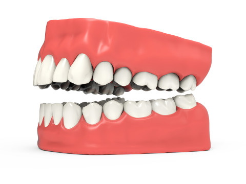 Teeth 3D Model