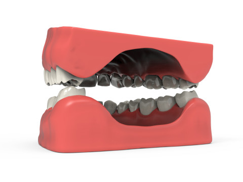 Teeth 3D Model